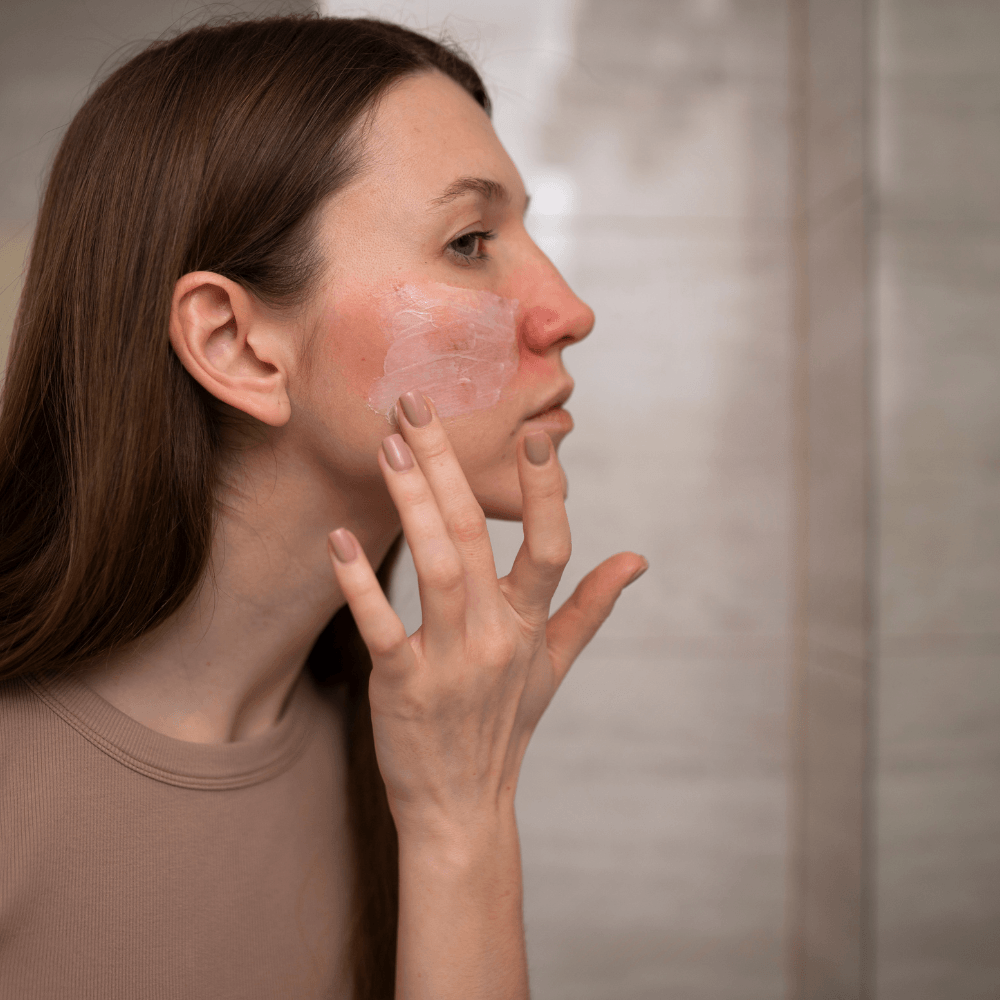 Nahaufnahme einer Frau im Profil, die eine hautberuhigende Creme auf eine gerötete Hautstelle im Gesicht aufträgt, passend zur Hautpflege-Philosophie "Deine Haut. Ganz ohne Filter
