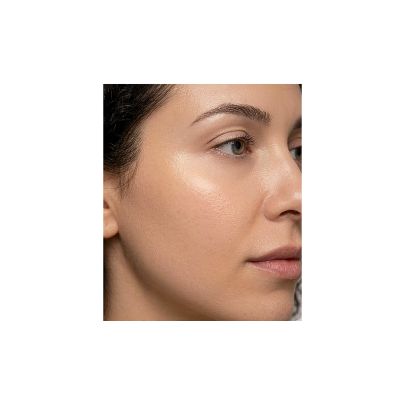 Nahaufnahme einer Gesichtshälfte, aufgenommen als Nachher-Bild nach der Ice Blue Hydro-Facial-Behandlung zur Dokumentation eines reinen, hydratisierten und ebenmäßigen Hautbilds.