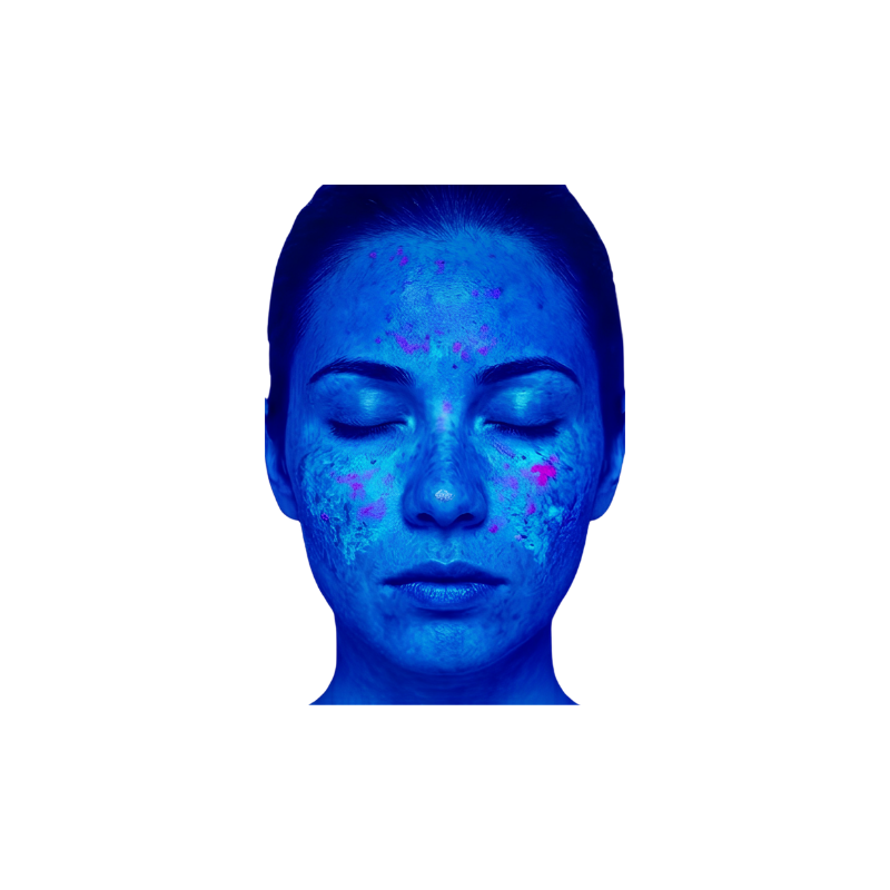 Computergenerierte Analyse-Darstellung eines Gesichts mit blauem Filter, der Hautareale wie Unreinheiten und Pigmentstörungen durch farbliche Hervorhebung für die KI-gestützte Hautanalyse sichtbar macht.