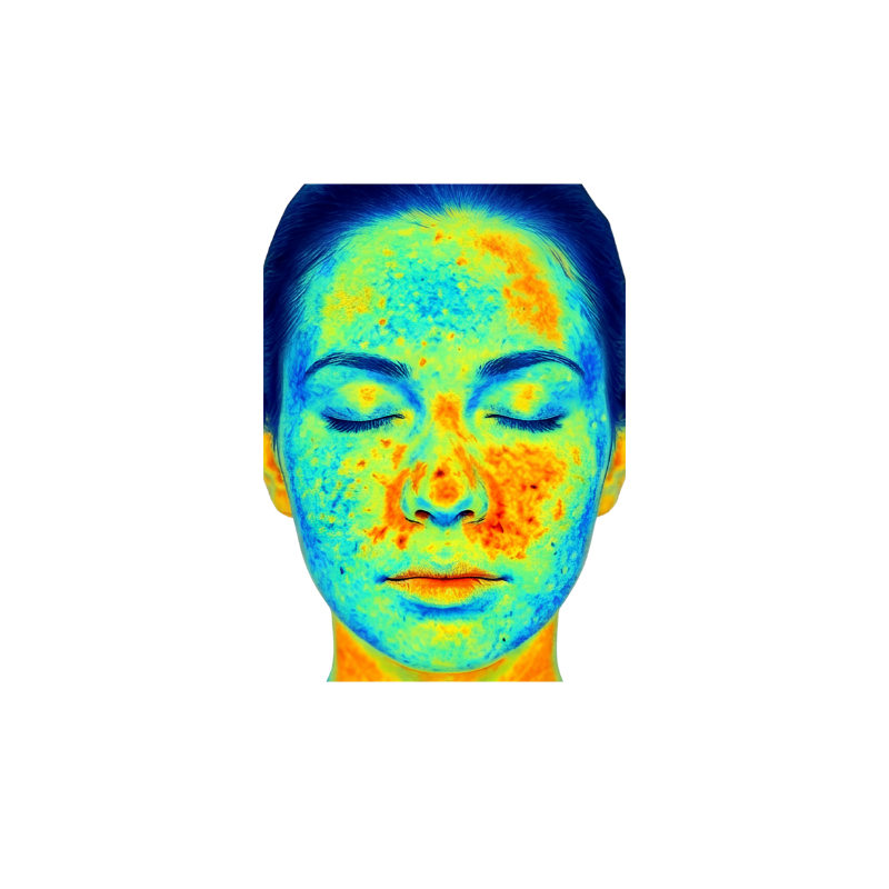 KI-gestützte Hautanalyse mit DemiDora Oracle Vision Pro: Hochauflösende Darstellung von Hautbeschaffenheit, Fältchen und Pigmentierungen zur präzisen Diagnose.