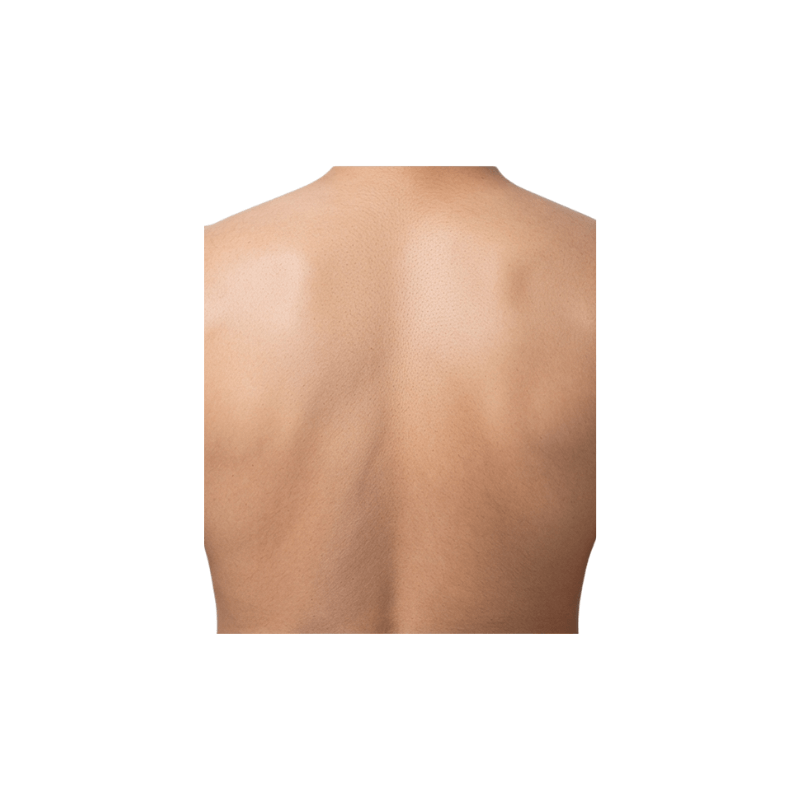 Nachher-Ergebnis: Professionelle Rückenpartie nach der Behandlung mit dem DemiDora Soprano LuminaCore 360 Diodenlaser; zeigt eine perfekt haarfreie, glatte Hautoberfläche ohne Irritationen dank fortschrittlicher Tri-Wave-Lasertechnologie.