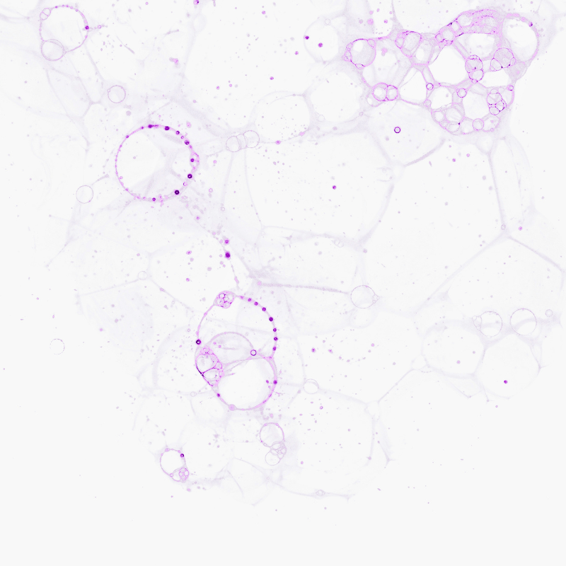 Mikroskopische Aufnahme von runden, blasenartigen Lipidstrukturen und Tröpfchen in hellen Violett- und Lilatönen auf weißem Hintergrund.
